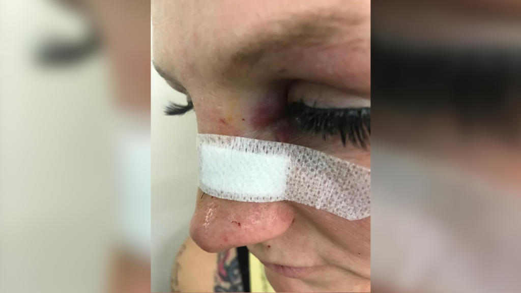 Partij Cindy Dandois tegen Senna van de Veerdonk gaat niet door.
