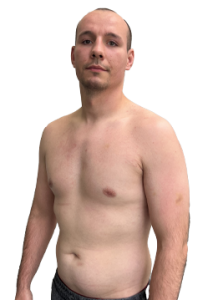 Patryk Molka